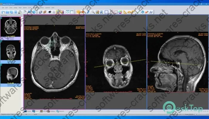 Sante Dicom Viewer Pro Keygen