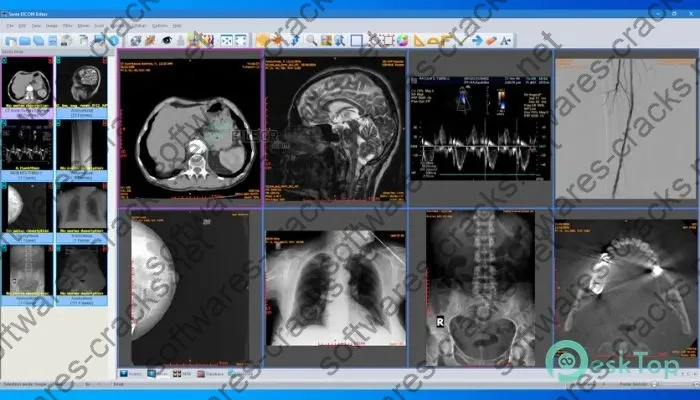 Sante Dicom Editor Crack